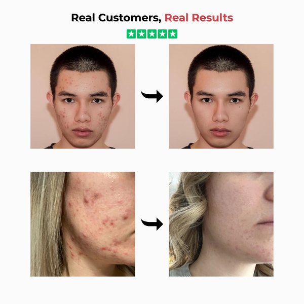 Radiant Rice Glow Serum